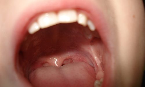 teeth-209860_1280